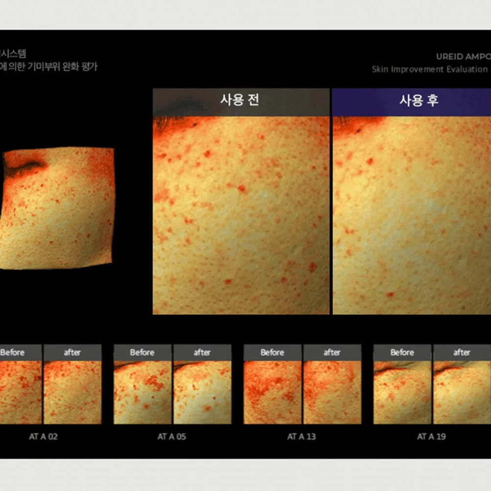 비에논 우레이드 기미앰플 검버섯 흑자 나이아신아마이드 미백앰플 상세 이미지 2