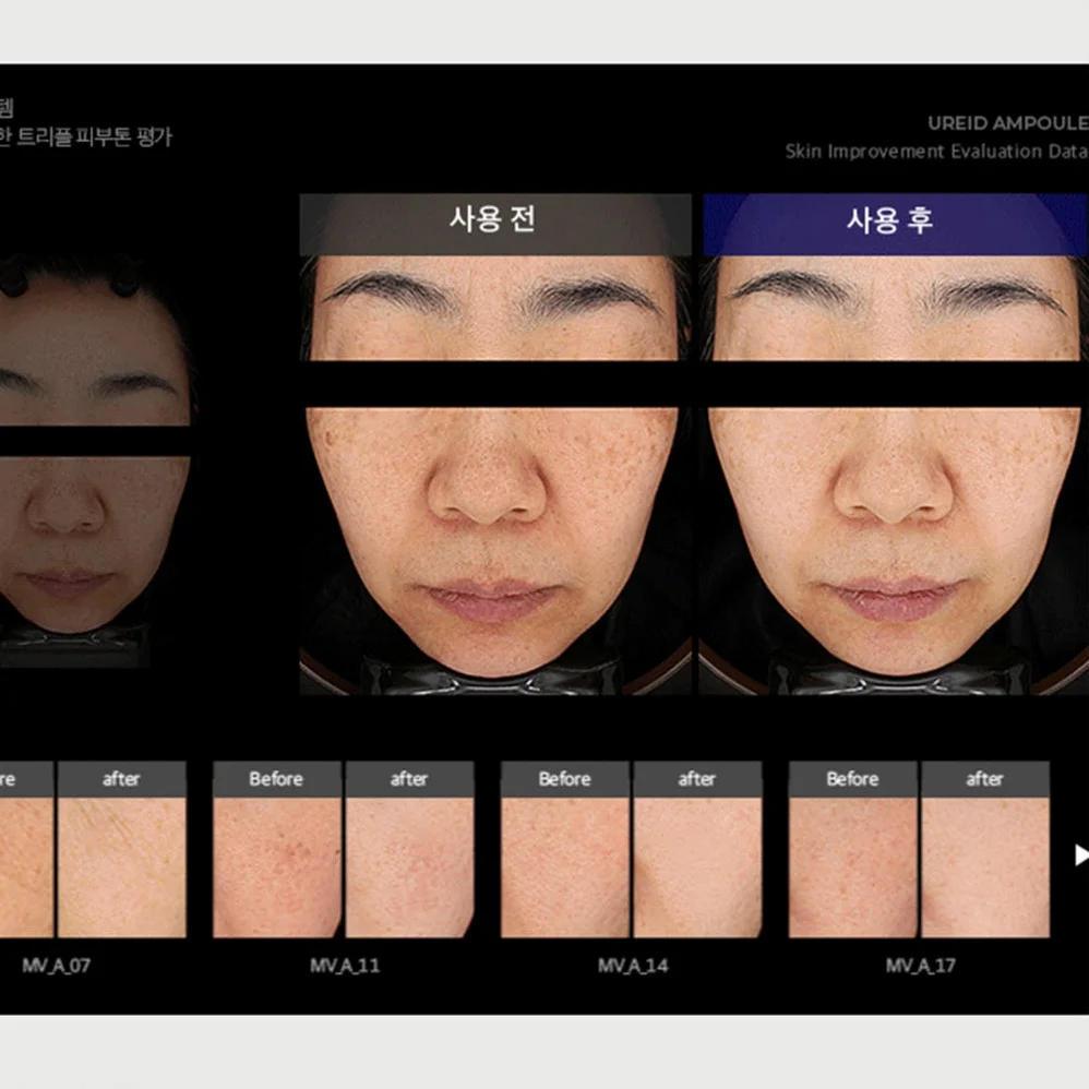 비에논 우레이드 기미앰플 검버섯 흑자 나이아신아마이드 미백앰플 상세 이미지 5